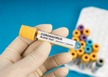 Coronavirus Private Testing Laboratories in India